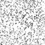 Tratamento de coalescimento